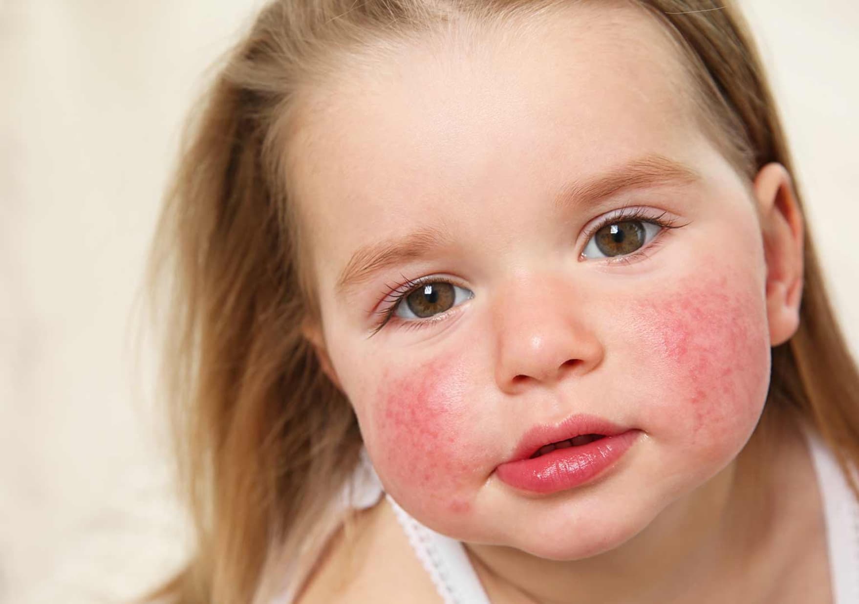 Enfermedades de la piel y alergias